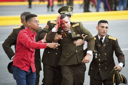 Un militar venezolano herido, momentos después del incidente.