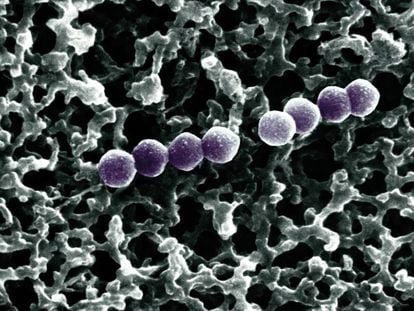 Las bacterias de la especie 'Streptococcus pneumoniae' pueden provocar neumonías letales.