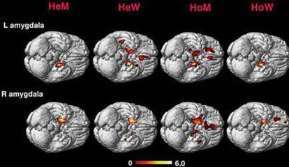 Variaciones en la amígdala cerebral según la orientación sexual.