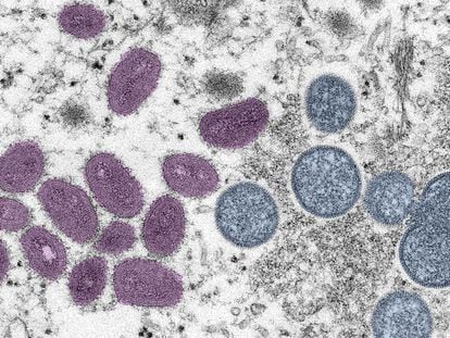Imagen de microscopía electrónica de una partícula de la viruela del mono.
