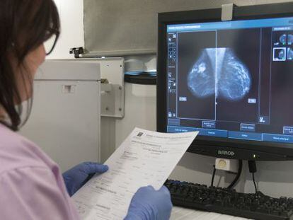 Mamografía realizada en 2014 en Andalucía a una mujer en una unidad móvil de detección precoz de cáncer de mama.