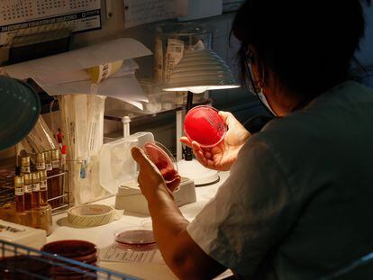 Una profesional sanitaria observa una placa en el área de laboratorio dedicada a microbiología del hospital La Paz, en Madrid.