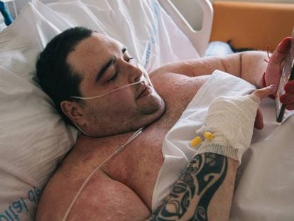 Teófilo Rodríguez, Teo, el joven de Turís de 385 kilos que esta ingresado en el Hospital de Manises, Valencia.