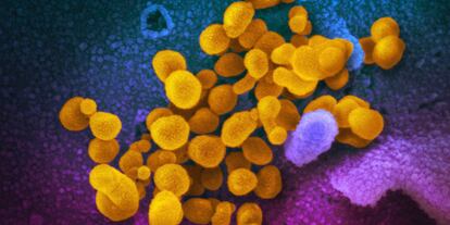Imagen de microscopio del virus SARS-CoV-2 (amarillo)