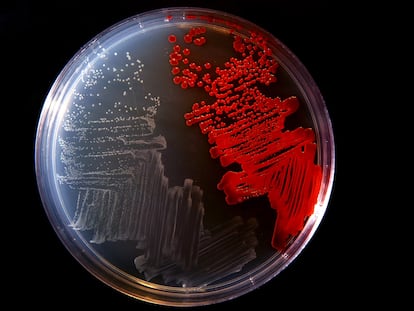 Un cultivo de bacterias en laboratorio.