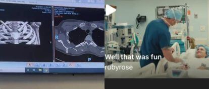 Imágenes del paso por quirófano de Ruby Rose que la actriz ha compartido en redes sociales.