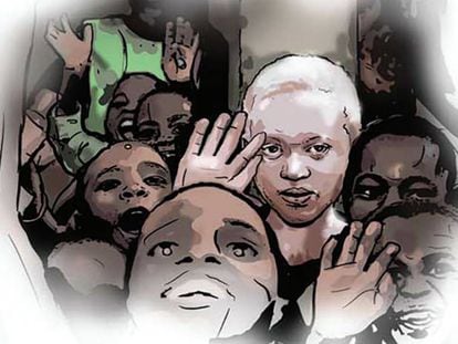 En Malaui, hay entre 7.000 y 10.000 personas con albinismo.