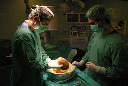 Limpieza de un hígado recibido en el hospital Virgen del Rocío (Sevilla) para su trasplante.