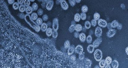 Virus H7N9 de gripe aviar saliendo de una c&eacute;lula. 