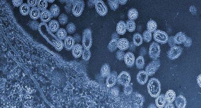 Virus H7N9 de gripe aviar saliendo de una célula.