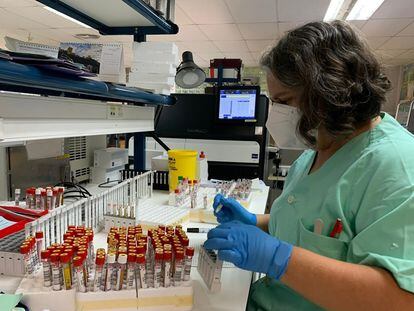 Una enfermera trabaja en el Hospital Virgen de la Victoria con pruebas para la detección precoz del VIH.