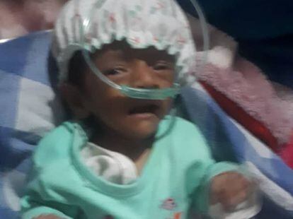 Omma, de nueve meses, ingresada en el Hospital Infantil de Ataturk.