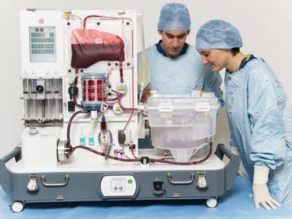 Dos personas observan un hígado en la máquina de perfusión 'OrganOx'.