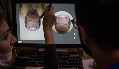 Doctores evalúan a un paciente en una clínica turca.