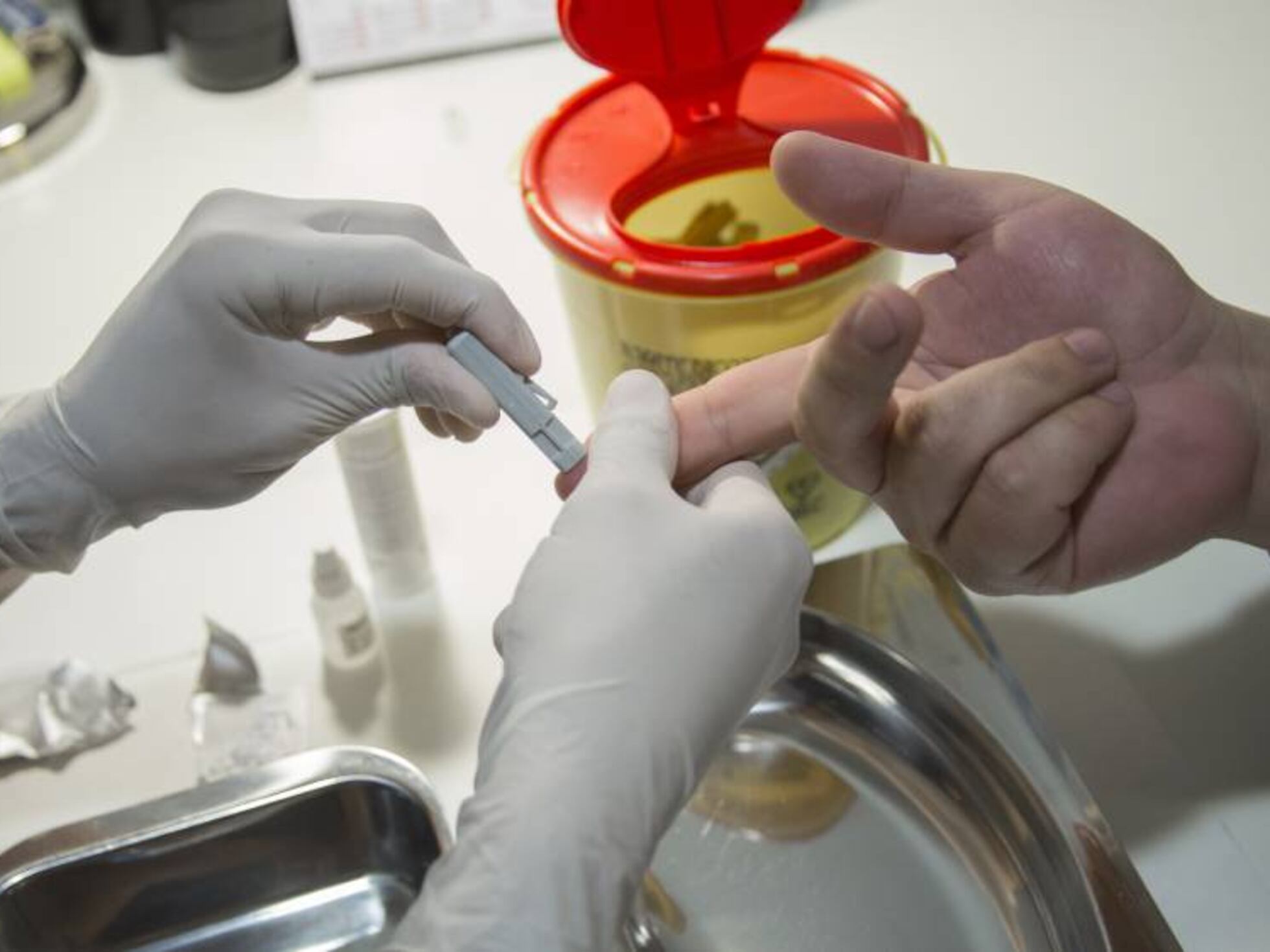 Por qué la sífilis es inmune a los antibióticos? | Ciencia | EL PAÍS Por qué la sífilis es inmune a los antibióticos? | Ciencia | EL PAÍS