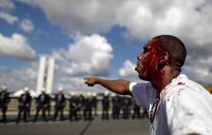 Un manifestante después de haber sido herido en la cabeza durante la protesta.