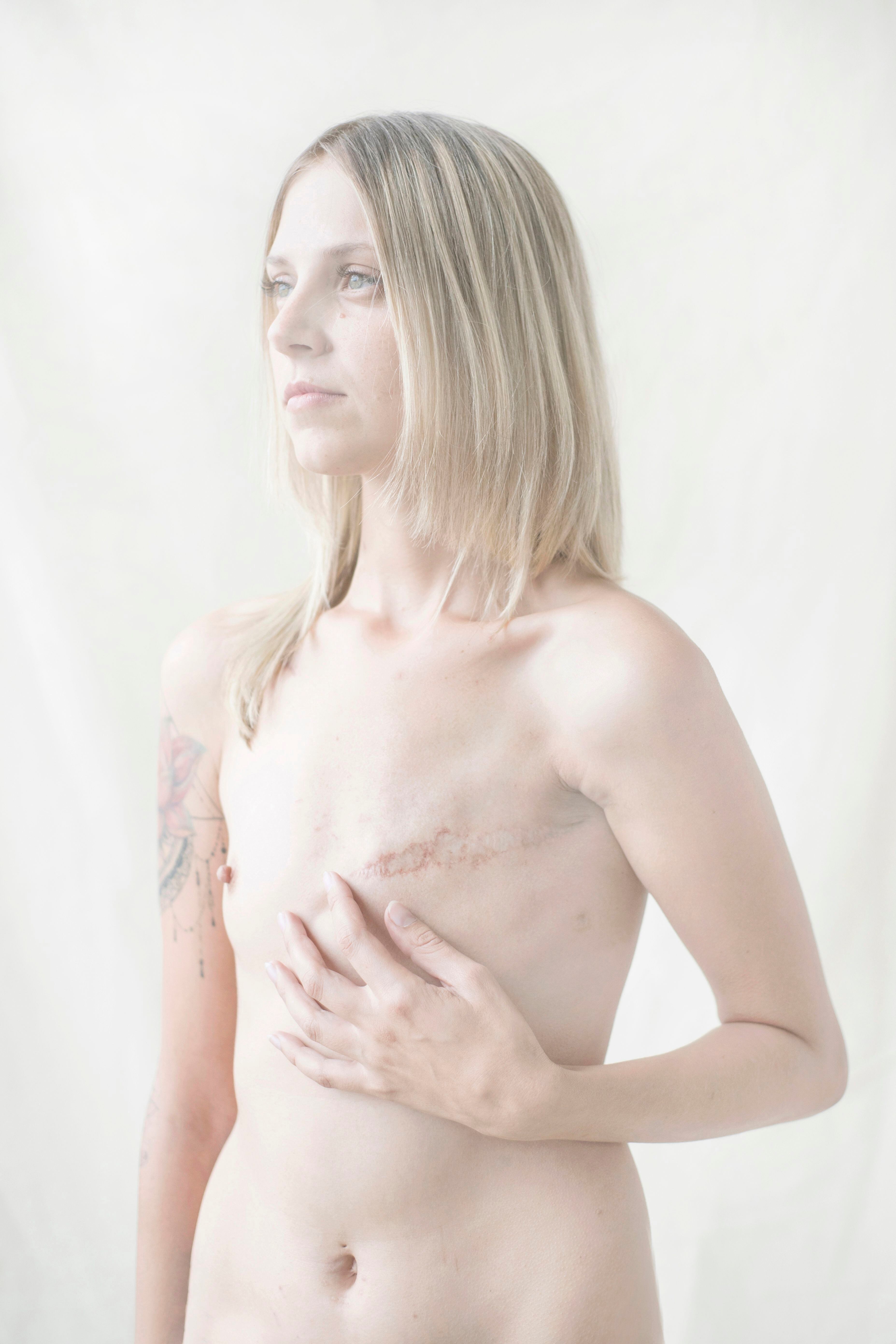 Retrato de Anya, víctima de cáncer de mama, en una imagen de Sergei Stroitelev, finalista de los Premios Luis Valtueña.