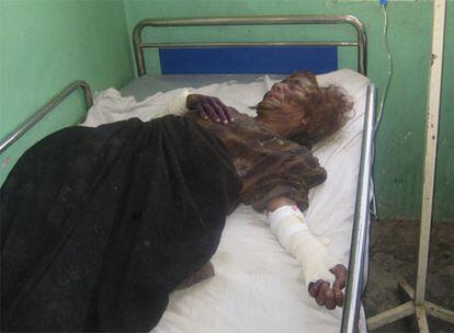 Una mujer yace en la cama de un hospital de la provincia de Farah tras la ofensiva militar de EE UU.