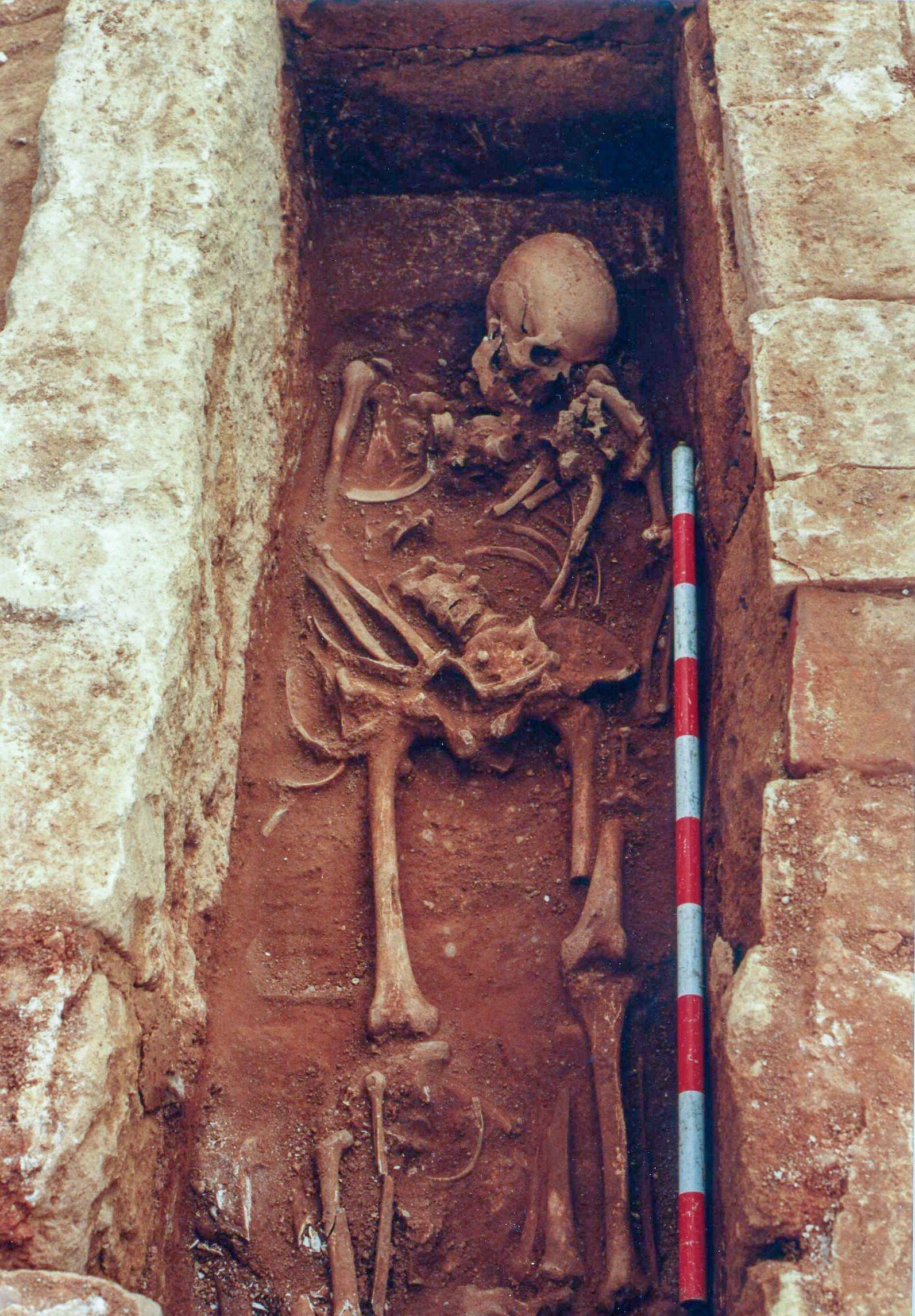 Esqueleto de un cristiano enterrado en Cercadilla que vivió durante el emirato (756-929)  y que recibió un gran hachazo en la cabeza.