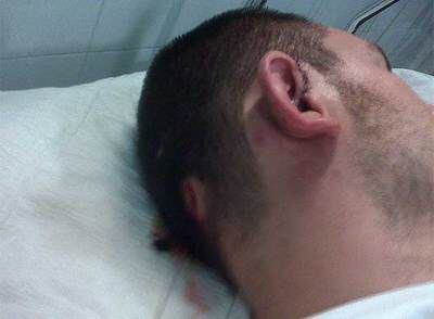 Uno de los futbolistas agredidos descansa en el hospital.