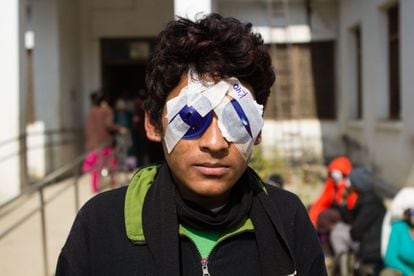 También hay jóvenes con cataratas. Según el coordinador del equipo médico, Ripun Dahal, las causas de las cataratas en Nepal son la radiación UVA, la polución y la alimentación.