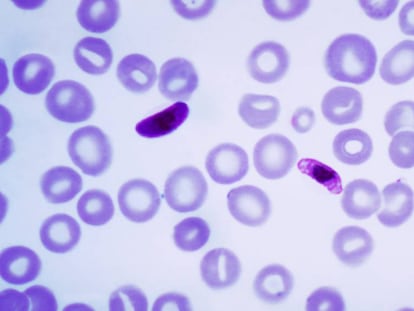 Muestra de sangre que contiene varias formas del par&aacute;sito de la malaria, &#039;Plasmodium falciparum&#039;