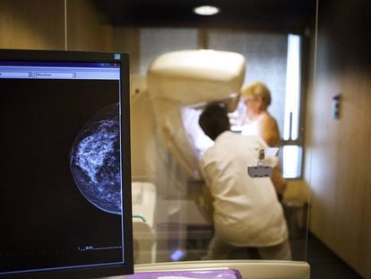 Un t&eacute;cnico realiza una mamograf&iacute;a a una paciente