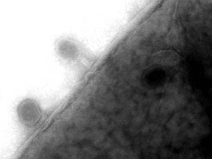 Virus fagos en la membrana de una bacteria &#039;E. coli&#039;.