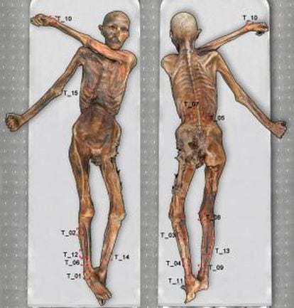 Mapa de los tatuajes del hombre de hielo, Ötzi, realizado por EURAC.