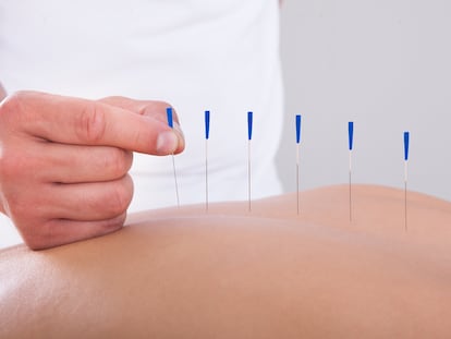 ¿Eres del área de salud? ¡Este Máster en Acupuntura es para ti!