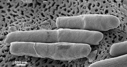 Una colonia de C. difficile vista al microscopio.