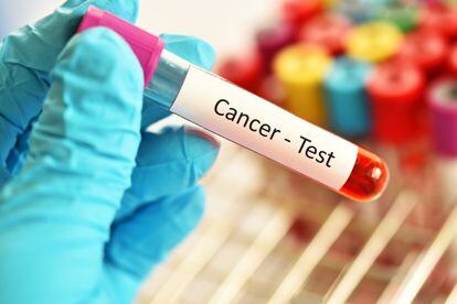 Ya existen biomarcadores para una treintena de tipos de cáncer, entre ellos, los de mayor prevalencia, como el colorrectal y los de mama, próstata, melanoma, ovario o pulmón.