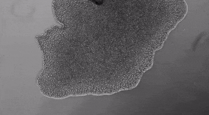 Movimiento de un placozoo observado con un microscopio.