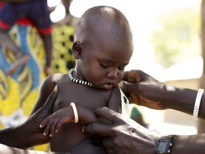 Un niño es atendido por un médico para conocer su estado de desnutrición.