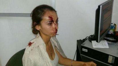 Karla Janeth Silva tras la agresión en una imagen difundida en redes sociales.