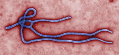 Imagen del virus del Ébola.
