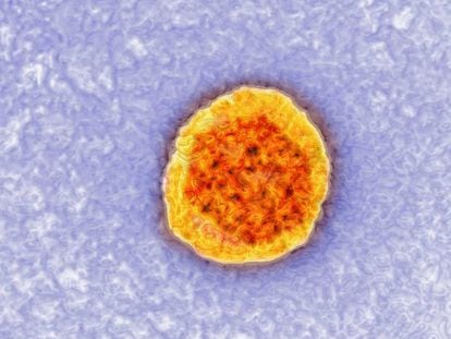 Imagen tomada con un microscopio del virus de la hepatitis C.