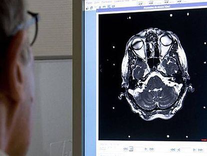 Un metge revisa una prova diagnòstica del cervell d'un pacient.
