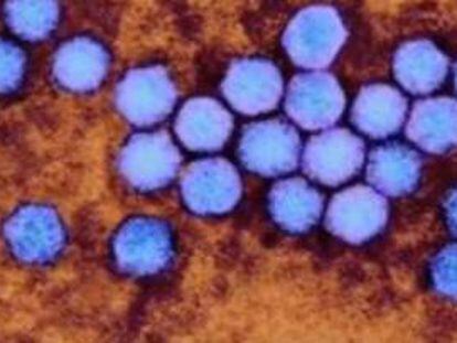 Imatge microscòpica de l'enterovirus.