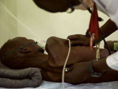 En Sudán del Sur, años de guerra y un sistema de salud frágil han dejado a muchas personas sin acceso a tratamiento para enfermedades como la tuberculosis. En Sudán se repite el problema
