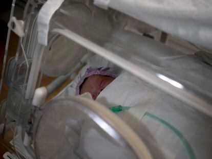 Ivanna, de un mes de vida, en una incubadora luego de recibir tratamiento por retinopatía.