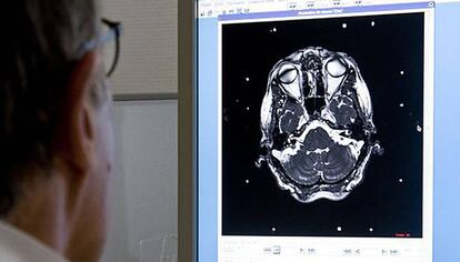 Un metge revisa una prova diagnòstica del cervell d'un pacient.