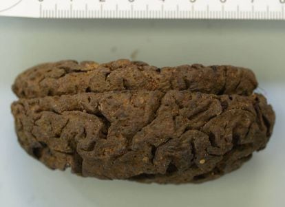 Uno de los 45 cerebros conservados en La Pedraja.