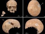 Cráneo de uno de los individuos asesinados en la cueva de Els Trocs con impactos de flechas y objetos contundentes.