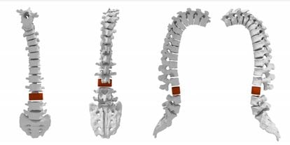 Reconstrucción de la columna vertebral del chico de Torrenueva.