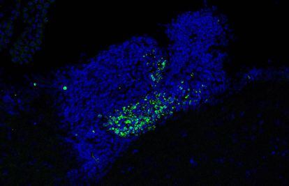 Acumulaci&oacute;n de c&eacute;lulas muertas (puntos verdes) en zonas de generazi&oacute;n de neuronas