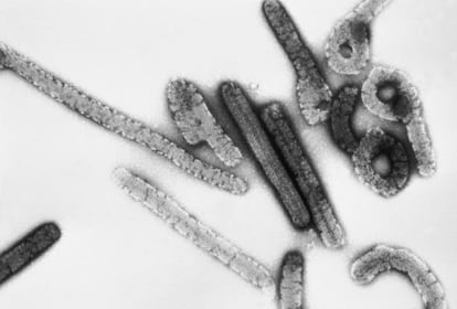 Virus de Marburgo.  CDC (Foto por ARCHIVO) 01/01/1970