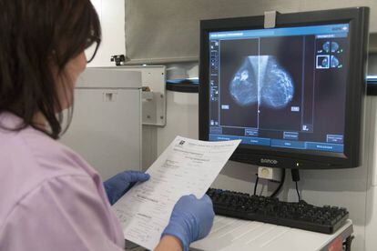Una médico con una mamografía.
