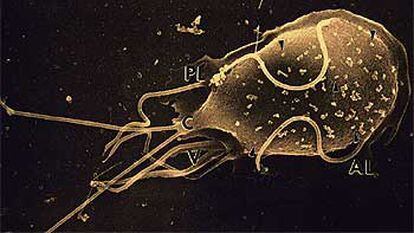 Imagen microscópica de una bacteria.