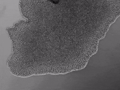 Movimiento de un placozoo observado con un microscopio.